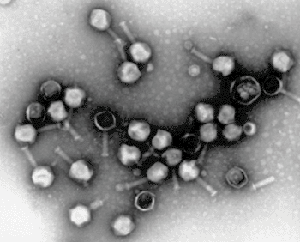 investigan-prueba-de-orina-economica-para-detectar-cancer-de-prostata
