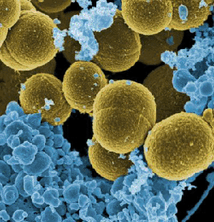biosensor-detecta-bacterias-resistentes-a-los-antibioticos