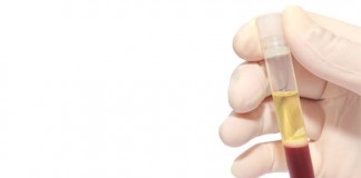 El plasma de las personas que vencieron la infección por el virus del Ébola es clave en el tratamiento de otros contagiados