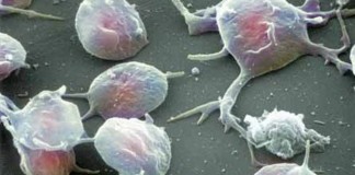 Nuevas biopsias líquidas basadas en el análisis del ARN tumoral contenido en las plaquetas