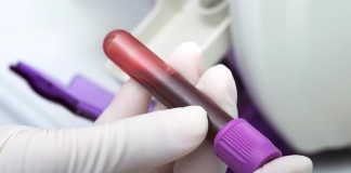 Un nuevo supresor tumoral relaciona cáncer y envejecimiento en el sistema hematopoyético