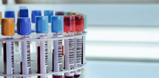 Etapa Crítica de la Hemostasia: Procedimientos Preanalíticos