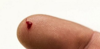 Biochip realiza recuento de células sanguíneas en el punto de atención