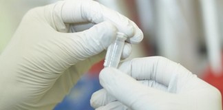 Uroguanylina: una nueva diana antiobesidad