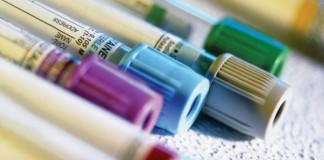 Niveles elevados de hormonas sexuales aumentan riesgo de fibromas uterinos