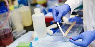 Hallan una posible nueva diana antitumoral