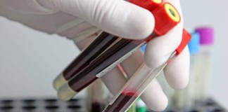 Practical Guidance on Primary Adrenal Insufficiency