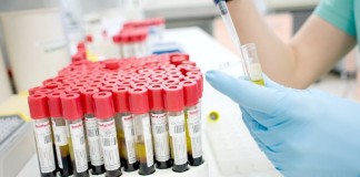 Ten Ways to Improve the Quality of Send-out Testing