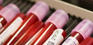 Caso clínico de interés: Síndrome hipereosinofílico idiopático