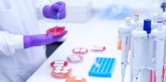 Tuberculosis, una amenaza latente