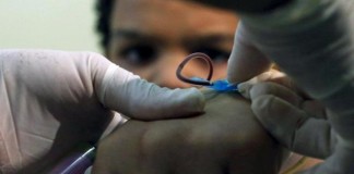 Trombofilia: ¿Cómo y cuándo se estudia?