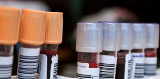Un análisis de sangre podría transformar el diagnóstico de la tuberculosis