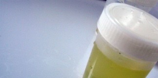 10-minute urine test can measure specific compounds from food consumed