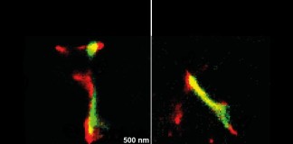 Researchers identify when Parkinson’s proteins become toxic to brain cells