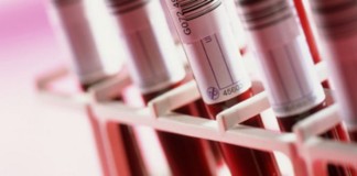 Time Course and Diagnostic Accuracy of Glial and Neuronal Blood Biomarkers GFAP and UCH-L1 in a Large Cohort of Trauma Patients With and Without Mild Traumatic Brain Injury