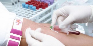 Blood test may give early warning of skin cancer relapse