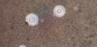 Criptococosis: una enfermedad que llega con el aire