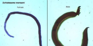 ¿Qué es Esquistosomiasis y cómo se diagnostica?