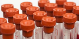 Impacto del estado del hierro en la insuficiencia cardiaca