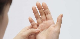 For lupus patients, anti-inflammatory cells are maturing into wrong cell type