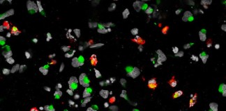 El Zika infecta las células madre neurales que producen la corteza cerebral