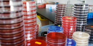 Nuevo Consenso: Criterios de diagnóstico y tratamiento de la tuberculosis infantil