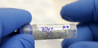 Transmisión sexual del virus de Zika