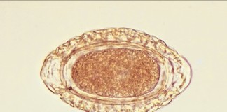 Estudian a Dioctophyma renale, un extraño parásito que afecta a perros y humanos