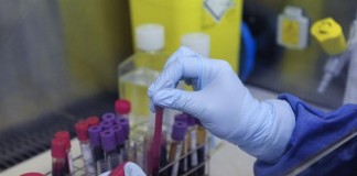 Current hepatitis C virus testing guidelines miss too many cases, study suggest