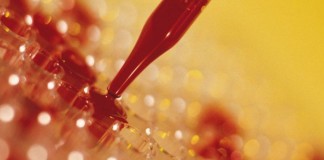 Researchers find new clue in lupus autoantibody production