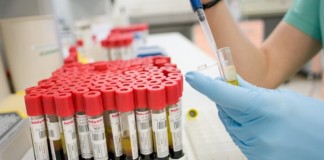 New sensitive method for early detection of amyloidosis in humans