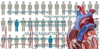Una variante genética rara aumenta el colesterol HDL y el riesgo de enfermedad coronaria