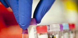 Prueba multigénica identifica cáncer de mama precoz