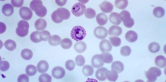 Novedosa prueba para la malaria establece nuevo estándar de oro