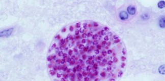 Does a common parasite play a role in rage disorder?