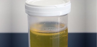 Desarrollan prueba no invasiva para cáncer de próstata con ARN exosomal