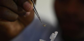 La malaria es la infección que causa más muertes fetales en el embarazo