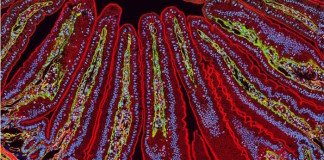Interacciones gen-microbiota contribuyen a la patogénesis de la enfermedad inflamatoria del intestino