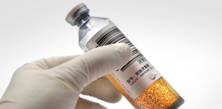 ¿Cuándo debe hacerse un hemocultivo?