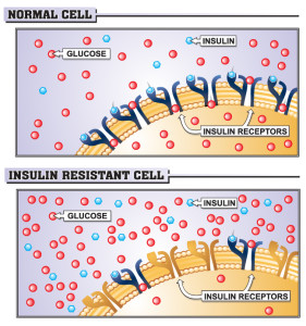 insulin-resistance1