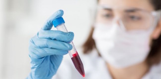 Researchers use liquid biopsy biomarkers to identify prostate cancer before surgery