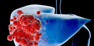Blood-born molecules could predict those who will develop liver cancer