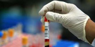 Marcadores bioquímicos de necrosis miocárdica