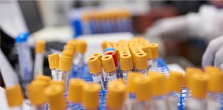 Aumento de Prolactina: causas y diagnósticos diferenciales