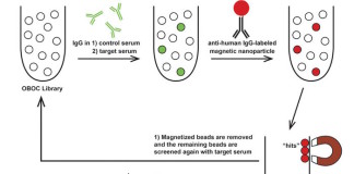 Biomarcador para autismo