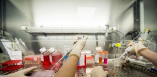 A urine sample could be used to diagnose a complex and serious pregnancy disorder