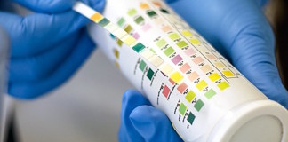 Urine tests not reliable for dehydration in older adults