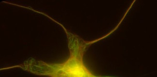 El mecanismo que permite a las neuronas formar extensiones nerviosas nuevas