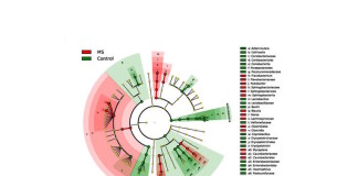 Multiple Sclerosis, the Gut Microbiome & Potential Therapies