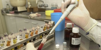 Identifican donde se refugia el VIH durante la terapia antirretroviral